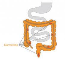 med darmkrebs