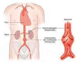 gesundheitsinformation.de