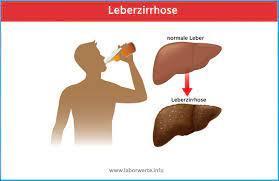 laborwert.info